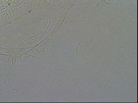 Echiniscus testudo image