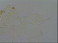 Echiniscus testudo image