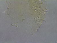 Echiniscus testudo image