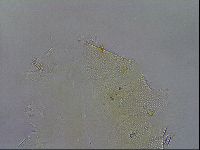 Echiniscus testudo image
