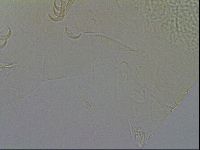 Echiniscus testudo image