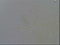 Echiniscus testudo image