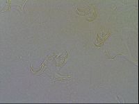 Echiniscus testudo image