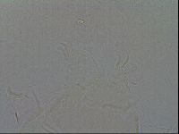 Echiniscus duboisi image