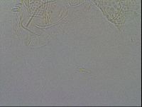 Echiniscus testudo image