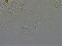 Echiniscus testudo image