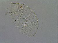 Echiniscus testudo image