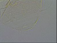 Echiniscus testudo image