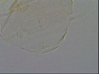 Echiniscus testudo image