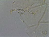 Echiniscus testudo image