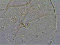 Echiniscus testudo image