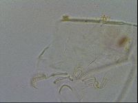 Echiniscus testudo image