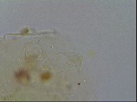 Echiniscus testudo image