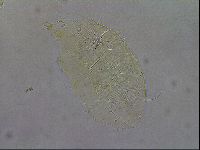 Echiniscus testudo image