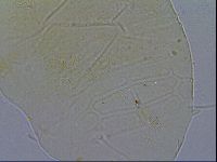 Echiniscus testudo image