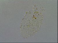 Echiniscus testudo image