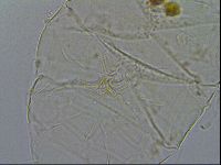 Echiniscus testudo image
