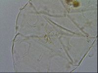 Echiniscus testudo image