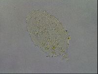 Echiniscus testudo image
