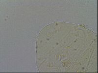 Echiniscus testudo image