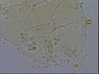 Echiniscus testudo image