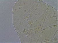 Echiniscus testudo image