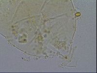 Echiniscus testudo image