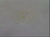 Echiniscus testudo image