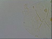 Echiniscus testudo image