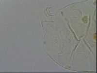 Echiniscus testudo image