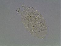 Echiniscus testudo image