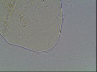 Echiniscus testudo image