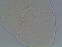 Echiniscus testudo image