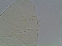 Echiniscus spiniger image