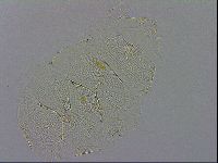 Echiniscus testudo image