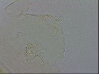 Echiniscus testudo image