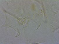 Echiniscus testudo image