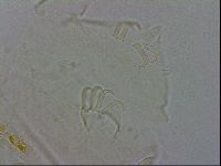 Echiniscus testudo image