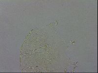 Echiniscus testudo image