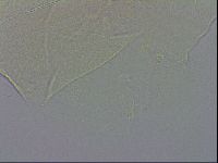 Echiniscus testudo image