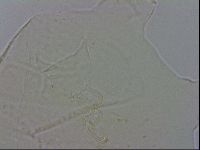 Echiniscus testudo image