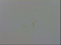 Echiniscus testudo image