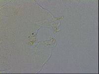 Echiniscus testudo image