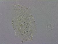 Echiniscus testudo image