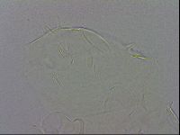 Echiniscus testudo image