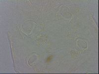 Echiniscus testudo image