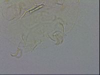 Echiniscus testudo image