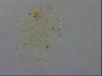 Echiniscus testudo image