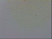 Echiniscus testudo image