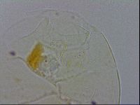 Echiniscus testudo image